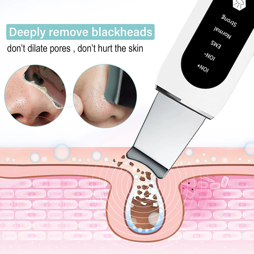 Blackhead Remover and Deep Cleansing Tool for Clearer Skin