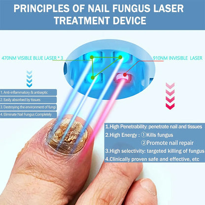 Nail Fungus Laser Treatment Device