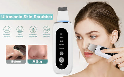 Blackhead Remover and Deep Cleansing Tool for Clearer Skin